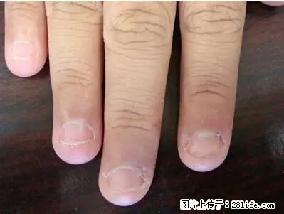 剪指甲、挖耳屎，这些日常小动作竟隐藏大危害！ - 延边生活资讯 - 延边28生活网 yanbian.28life.net